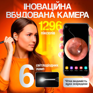 Прибор для удаления ушной серы с камерой Brillix 1296P Черный (PO-Black). Photo 3